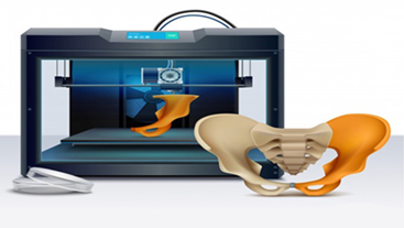 3D Printing Metal Material for Osteoporosis Procedures
